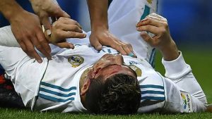 «رونالدو» يصاب بجرح خطير في الوجه أثناء مباراة