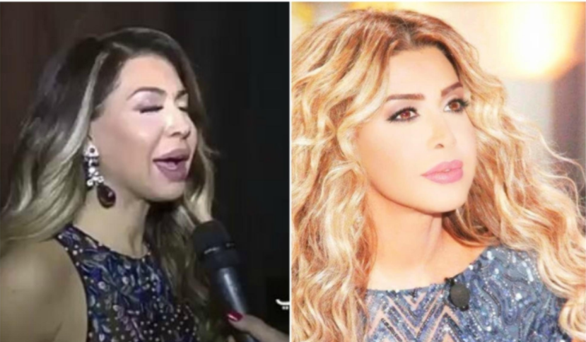 نوال الزغبي تصدم الجمهور بتغيير ملامحها