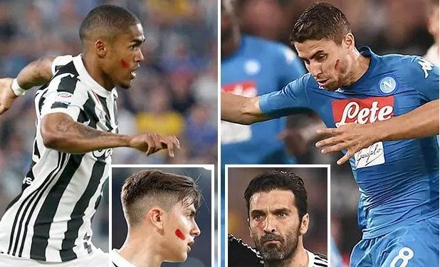 ظهور لاعبي الدوري الإيطالي بعلامات حمراء على وجوههم