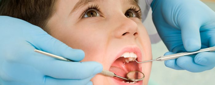 اسم مضاد حيوي لخراج الاسنان للاطفال