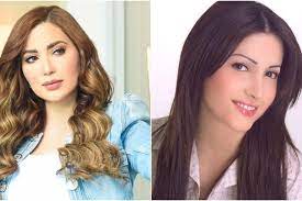 فنانات اعترفوا بإجراء عمليات التجميل